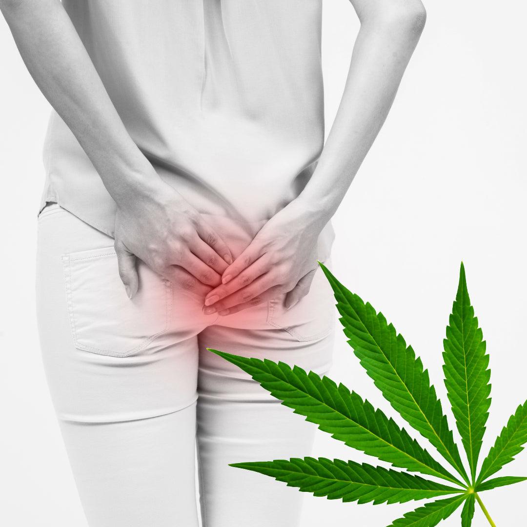 CBD bei Hämorrhoiden
